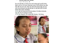 Cô giáo tát học sinh lớp 4 trong lớp học bị phạt 7,5 triệu đồng