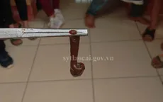 Gắp con nấc dài 6cm trong mũi bé trai vùng cao