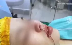 TP Hồ Chí Minh xử lý hàng loạt cơ sở phẫu thuật thẩm mỹ "chui"