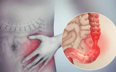 Phát hiện nguyên nhân gây nên hội chứng ruột kích thích