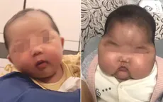 Trung Quốc thu hồi loại kem khiến trẻ nhỏ tăng cân bất thường
