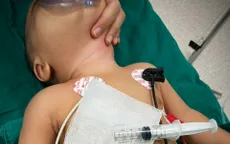 Đang ăn dặm thì quấy khóc liên tục, vào viện bác sĩ tìm ra thủ phạm ít ai ngờ