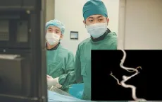 Hy hữu: Bé 3 tuổi bị... đột quỵ não