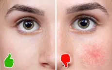 Từ bỏ cà phê có thể khiến làn da của bạn "xuống cấp" không ngờ