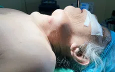 Bướu giáp khổng lồ khiến cụ bà 77 tuổi ăn không ngon, ngủ không yên