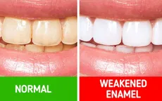 10 bí quyết chăm sóc răng miệng giúp bạn không bao giờ phải gặp nha sĩ