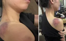 Công an truy tìm người đàn ông đánh vợ bầm dập