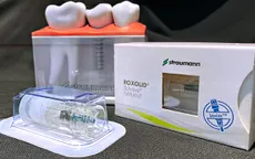 Trồng răng Implant ở đâu tốt tại Bình Dương?
