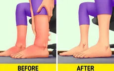 Giải quyết tình trạng chân sưng tấy với 10 mẹo đơn giản