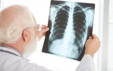 Đổi mới và hợp tác thúc đẩy tiến trình chấm dứt bệnh lao ở châu Á Thái Bình Dương