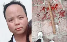 Dùng gậy đánh "tình địch" gãy nát chân, chấn thương sọ não