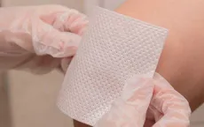 Gạc thông minh giúp theo dõi vết thương từ xa