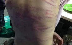 Bé gái 12 tuổi ở Hà Nội bị mẹ đẻ và người tình đánh đập dã man