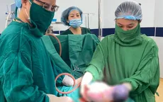 Bất ngờ với hình ảnh em bé sinh ra còn nguyên trong bọc ối đang vận động