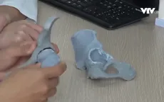Ứng dụng công nghệ 3D trong chẩn đoán bệnh xương khớp