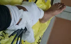 Va chạm với xe ba gác chở sắt, nam thanh niên bị 11 thanh sắt đâm xuyên chân