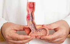 Cẩn trọng với nguy cơ ung thư dương vật