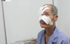 Mùa nóng đến gần, cẩn trọng nguy cơ ung thư da