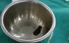 Gắp con vắt dài 5cm ra khỏi hốc mũi bệnh nhi 7 tuổi