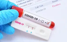 Có khả năng cho kết quả âm tính giả khi sử dụng bộ kit xét nghiệm COVID-19 nhanh