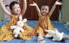 Tròn 1 năm ca mổ tách rời cặp song sinh Trúc Nhi - Diệu Nhi