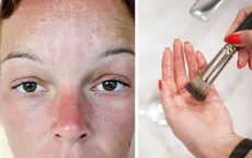7 điều nguy hiểm cần tránh khi da của bạn bị cháy nắng
