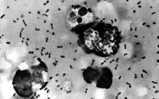 Phát triển loại vaccine dịch hạch mới sẵn sàng thử nghiệm trên người