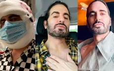 Marc Jacobs thừa nhận phẫu thuật thẩm mỹ