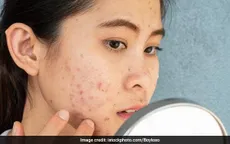 Ăn uống thế nào để ngừa mụn hiệu quả?