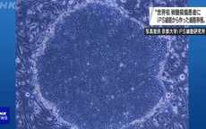 Thử nghiệm cấy ghép chữa tổn thương tủy sống từ tế bào iPS