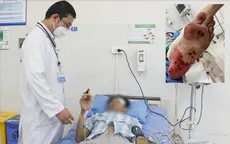 Cứu bệnh nhân bị ngộ độc chất gây tê cục bộ hiếm gặp