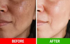 Sẵn sàng đón Tết với 8 mẹo "chữa cháy" cực đỉnh cho làn da