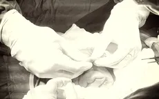 Cứu sống bé trai bị vỡ dị dạng mạch máu ruột non