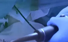 Thiết bị đầu dò 3D hỗ trợ phẫu thuật tim
