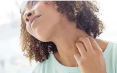 6 sai lầm thường thấy trong chăm sóc, bảo vệ da đối với người mắc bệnh chàm (Eczema)