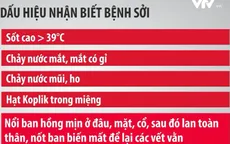 Bệnh sởi trở thành "mối đe dọa cận kề" trên toàn cầu