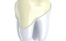 Bước tiến mới trong phát triển vật liệu nha khoa