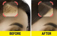 7 bí kíp điều trị hiệu quả tóc gãy rụng, gàu, xơ rối,...