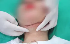 Liên tiếp cấp cứu các ca biến chứng thẩm mỹ