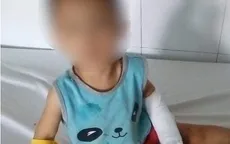 Cắt gân tay cháu bé 3 tuổi để dằn mặt người tình