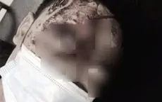 Bị kẻ lạ mặt tấn công nguy kịch khi đang ngủ cùng vợ