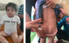 Bé 4 tuổi nhập viện với nhiều vết thương, nghi bị bạo hành