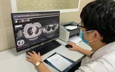 Bộ Y tế hướng dẫn các việc nên làm để tránh tình trạng "sương mù não" của hậu COVID-19