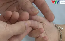 Nguyên tắc "3 sạch" phòng bệnh tay chân miệng