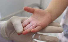 Những sai lầm khiến trẻ mắc tay chân miệng trở nặng