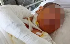 Nghi án chồng tưới xăng đốt vợ vì mâu thuẫn gia đình