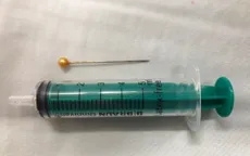 Gắp thành công cây kim sắc nhọn trong đường thở bé trai 10 tuổi