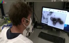 Bỏ phân biệt bệnh đậu mùa khỉ giữa các nước