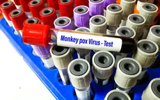 CDC Mỹ xác nhận bằng chứng về sự lây truyền bệnh đậu mùa khỉ tại địa phương