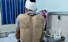 Nhóm côn đồ mang dao kiếm vào cổng bệnh viện truy sát người dân
